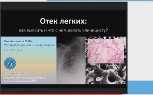 Отек лёгких Кузьков В.В. (РИТА) 2023