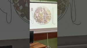 Что можно есть при диабете 2-го типа