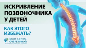 Как ИЗБЕЖАТЬ появления СКОЛИОЗА у РЕБЕНКА?