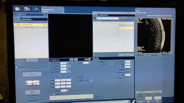 How to edit Protocols on GE 1.5 Tesla Live DEMO, How to set up and choose Protocols on GE 1.5 Tesla смотреть онлайн