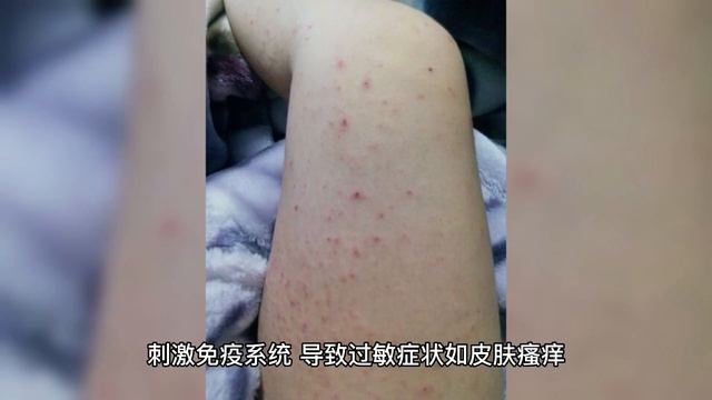 山药的“死对头”，两者不能同食，吃了就是没病找病