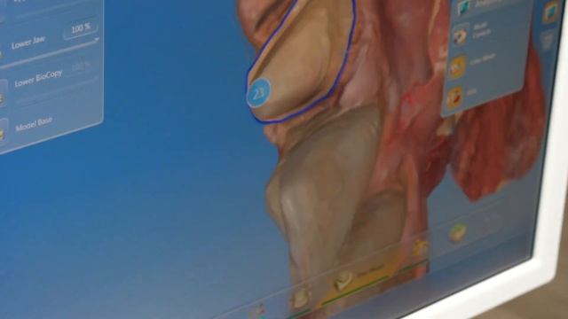 Dental Crown Procedure EXPLAINED смотреть онлайн