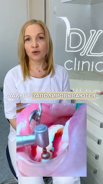Этапы профессиональной гигиены полости рта #стоматология #профгигиена #отбеливаниезубов