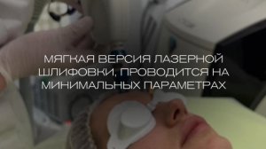 Лазерная шлифовка кожи на аппарате Harmony XL