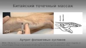 Массаж. Артрит суставов и точка выключения боли.