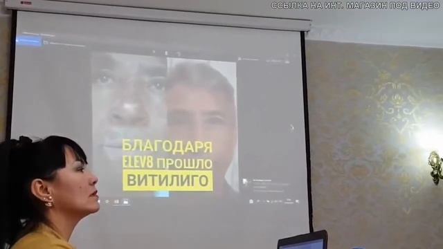 Мигрень Симптомы И Лечение - Врач смотреть онлайн