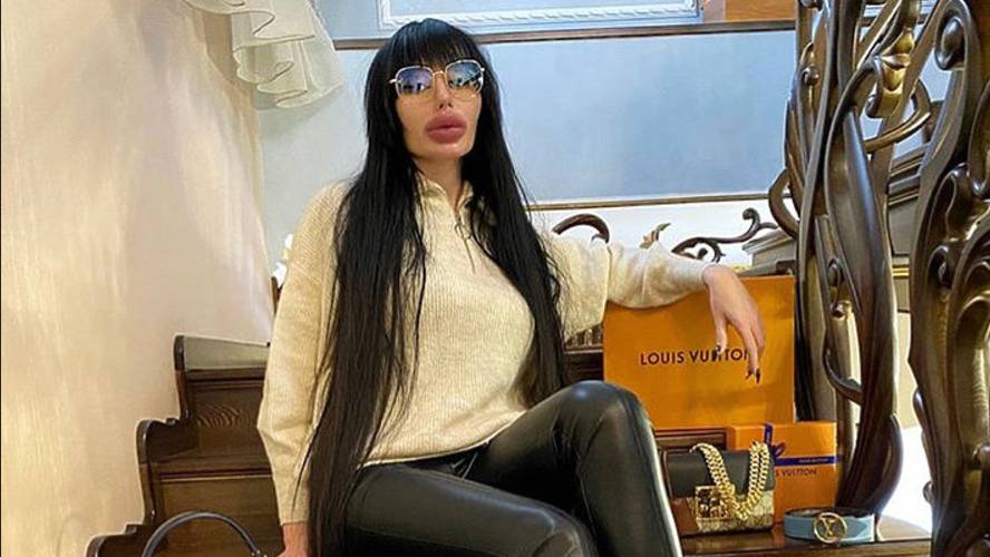 Испугавшая жениха гигантскими губами блогер Александра Домбаева появилась на ток-шоу Леры Кудрявцево