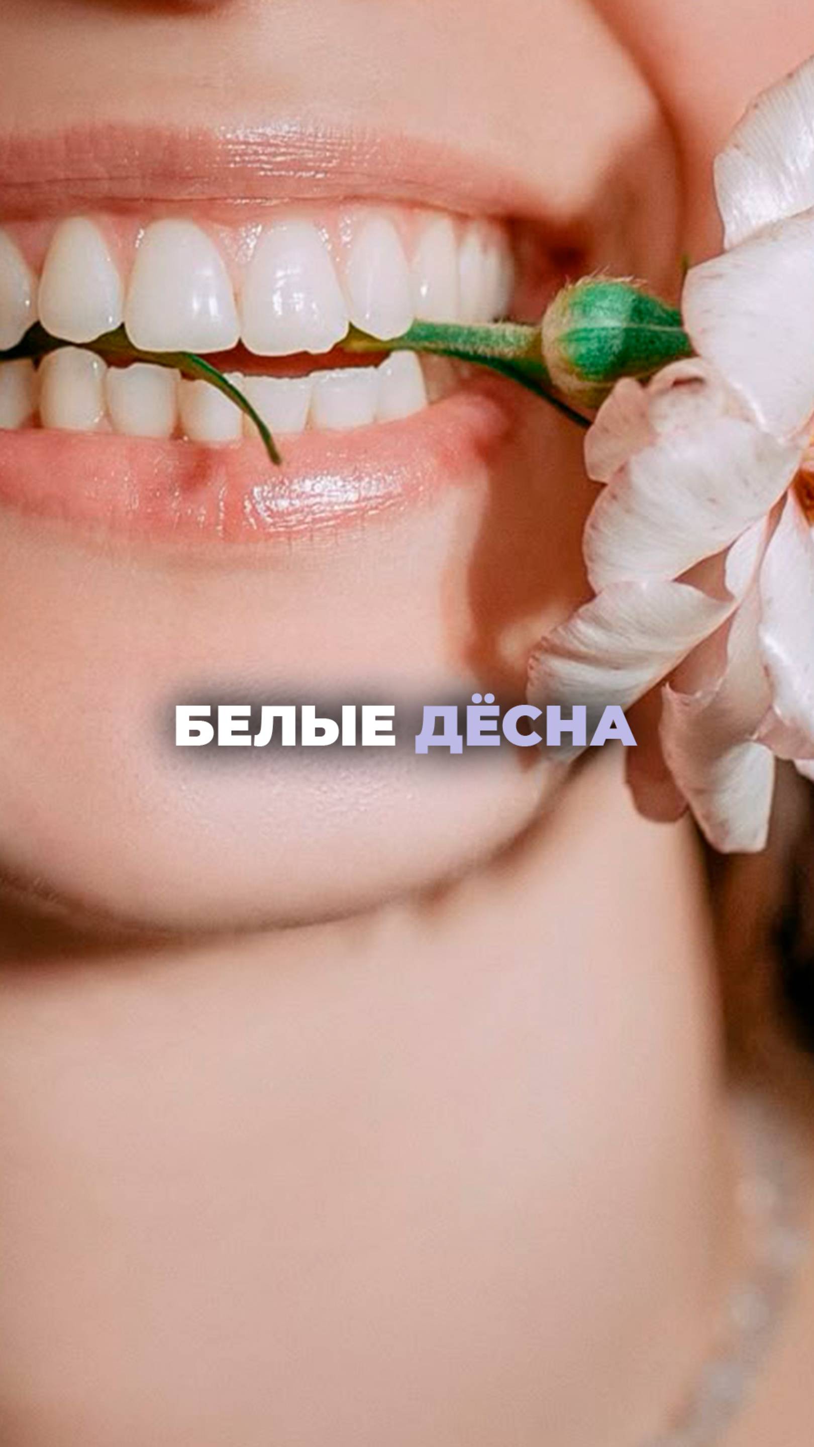 Белые десны