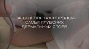 Термолифтинг RF-лифтинг на платформах Inmode и Geneo+