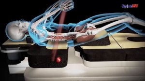 Когда эффективно лечение болей в спине на роботе SpineMT_