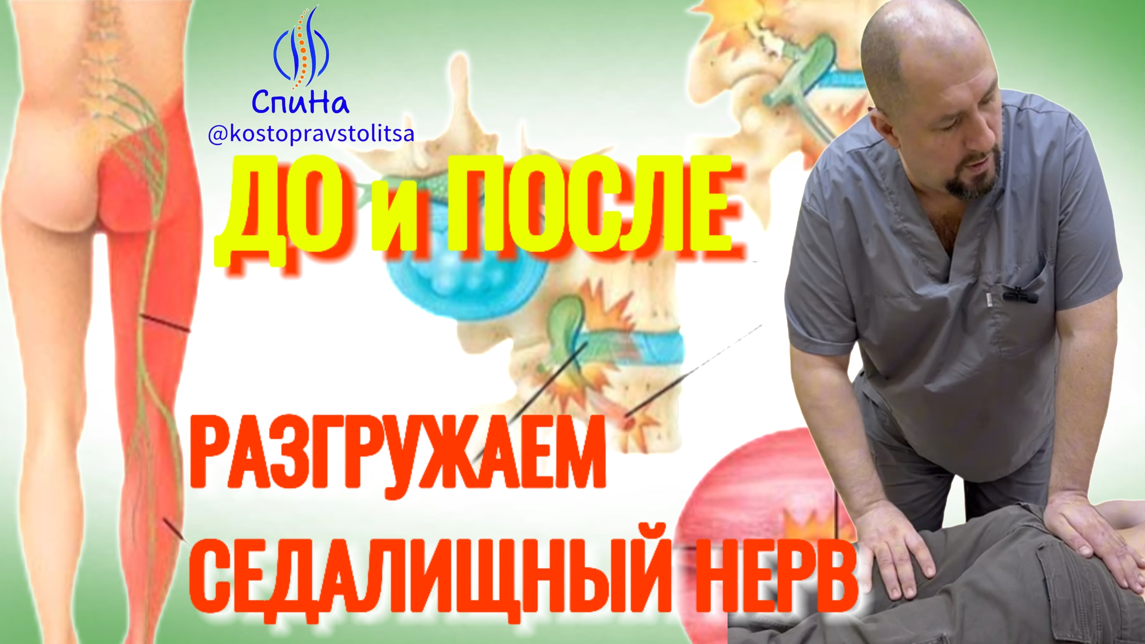 Работаем с седалищным. Разблокировка #костоправмосква #здоровьеспины #седалищныйнерв