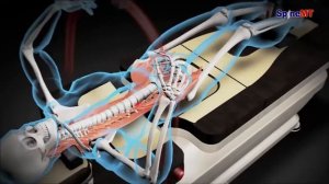 Мобилизация и декомпрессия позвоночника на роботе SpineMT K-1 в клинике МедиАрт