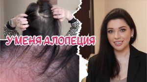 Я ЛЫСЕЮ. Уход при АГА! Миноксидил. Ценные советы. Генетика и наследственность. Облысение у женщин