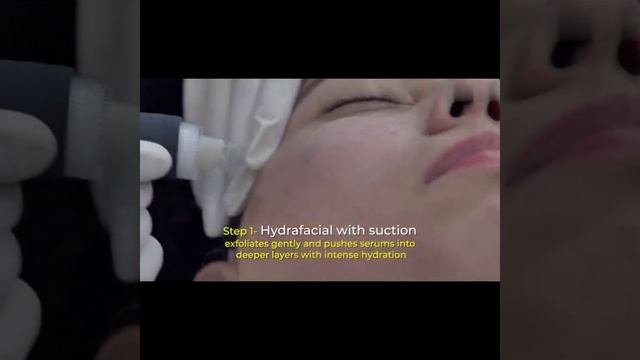 soft cure hydra facial with hydra machine/ result osm order now contact us 03104083990 смотреть онлайн