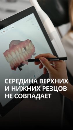 Правильное положение зубов
