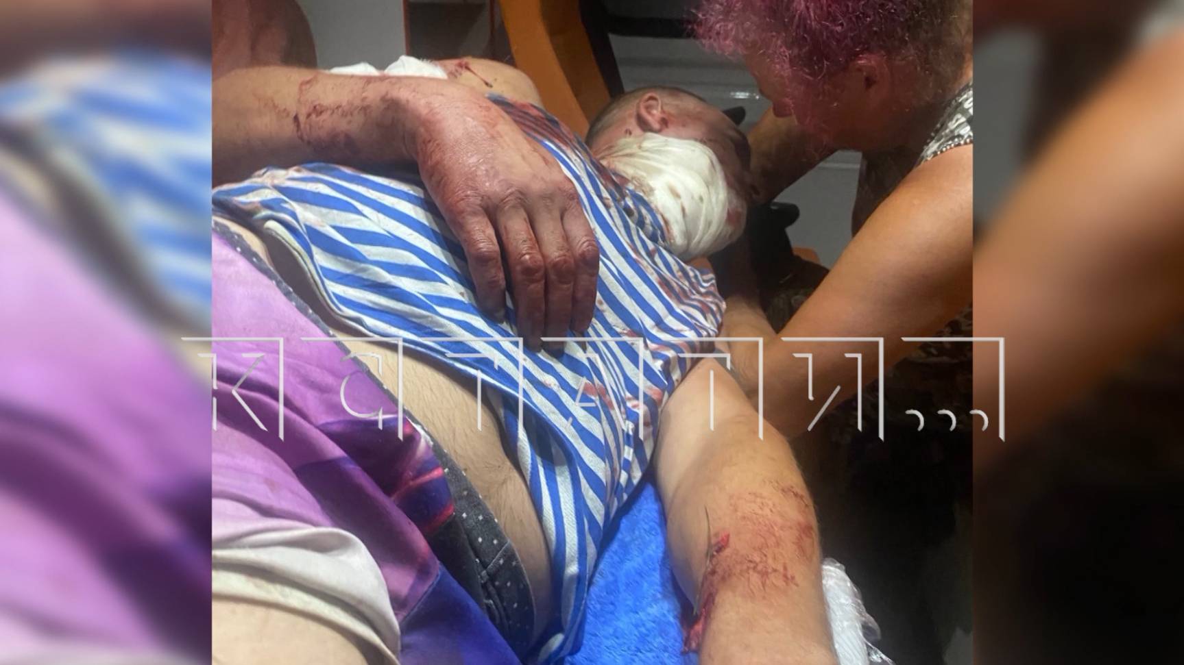 Хозяйка, которая натравила среднеазиатскую овчарку на соседа, выслушала приговор суда