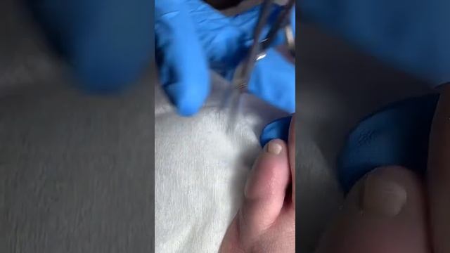 Прямой эфир, Гигиенический, комбинированный педикюр, покрытие под кутикулу +СПА смотреть онлайн