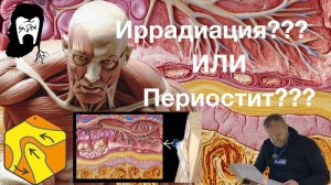 Боль в лице -Тройничный нерв? Иррадиация? Фиброз? Или что то ещё? ….асептический периостит
