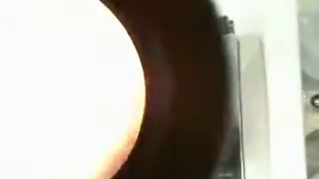 Strongyloides stercoralis смотреть онлайн