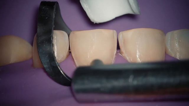 ВИНИРЫ, ВИНИРЧИКИ 🦷 / Доктор Тиунов смотреть онлайн