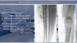 РЭВХ ВОКБ   008   катетерный тромболизис