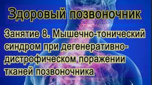 Занятие 8. Мышечно-тонический синдром при ДДИ позвоночника