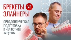 ПОДГОТОВКА К ЧЕЛЮСТНОЙ ОПЕРАЦИИ. БРЕКЕТЫ ИЛИ ЭЛАЙНЕРЫ?