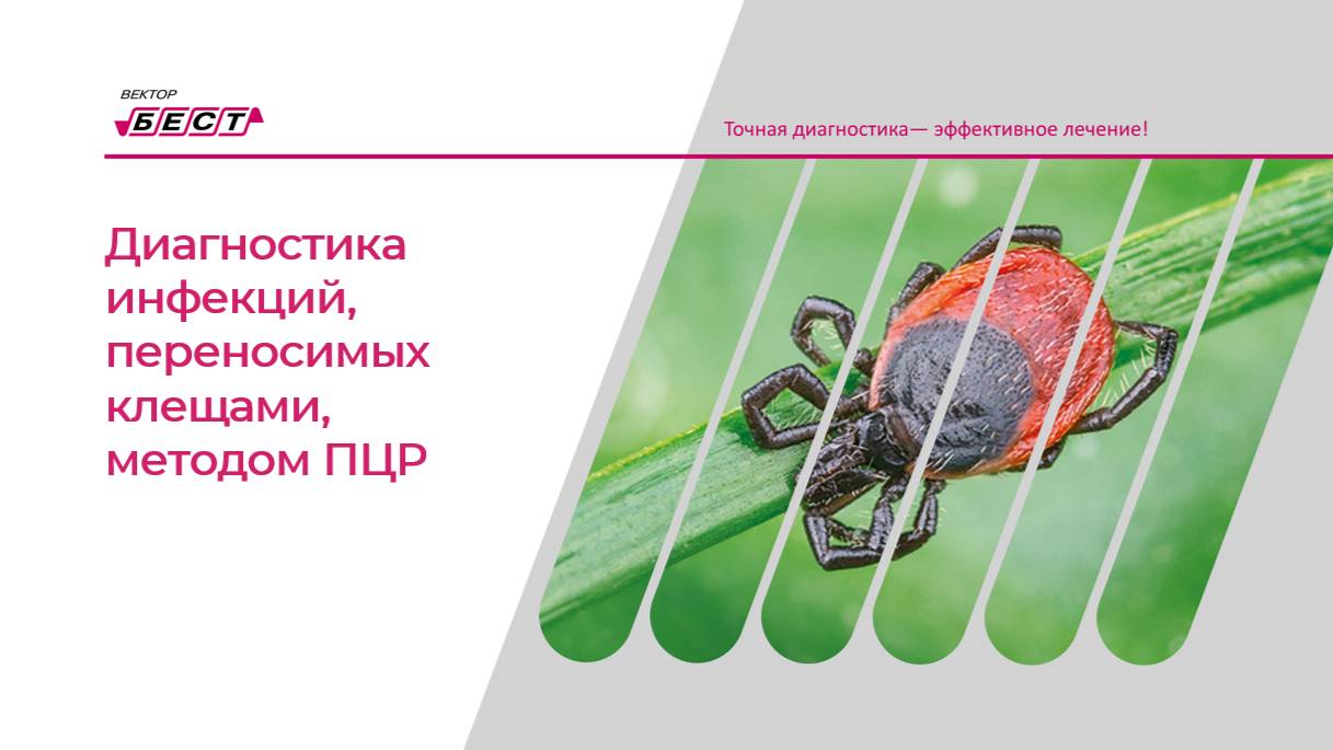 Диагностика инфекций переносимых клещами методом ПЦР