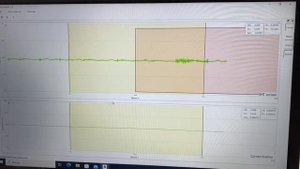 Измерение скорости сенсомоторной реакции с помощью ЭМГ
