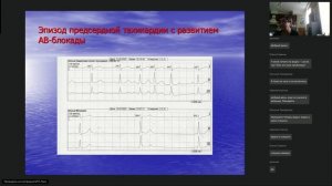 Вебинар 6. Нарушения ритма и проводимости