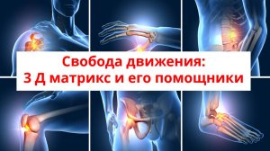Свобода движения: 3 Д матрикс и его помощники