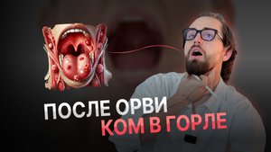 Как убрать ком в горле без лекарств: остеопатические техники и проверенные упражнения