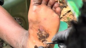 Jigger digging little Charlotte - - to watch full video, please subscribe @riseupsociety.net