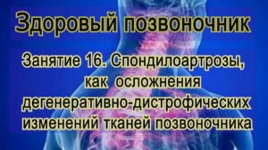 Занятие 16.   Спондилоартроз, как осложнение ДДИ позвоночника