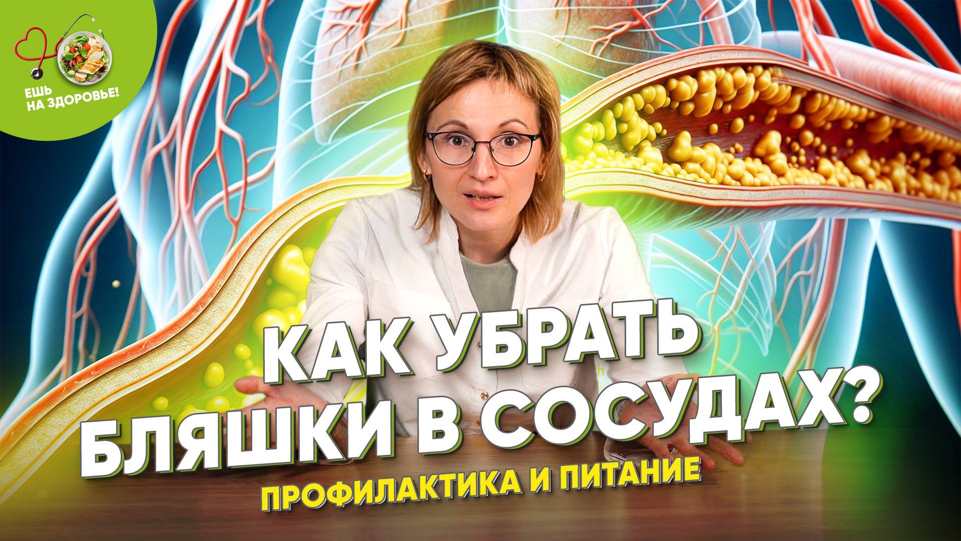 🆘Бляшки на стенках сосудах – что делать? Атеросклероз. Профилактика и лечение ⚡️