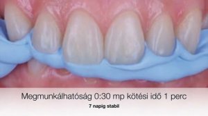 Zhermack Occlufast+ és Occlufast+Color harapásregisztráló termokróm A szilikonok