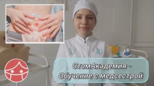 Аксессуар: пояс дополнительной фиксации калоприемника