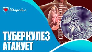 Туберкулез. Здоровье