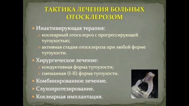 Отосклероз. Диагностика и реабилитация смотреть онлайн