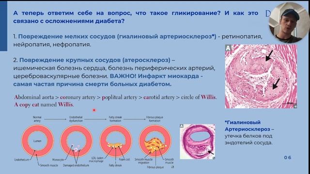 Биохимия сахарного диабета: патогенез, осложнения, диагностика