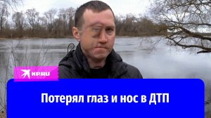 Белорус восстановился после жуткой аварии, в которой получил 35 переломов, потерял глаз и нос