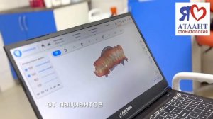 Что такое 3D-сканирование