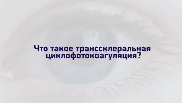 Лечение глаукомы методом лазерной циклокоагуляции. Глаукома. (360p)