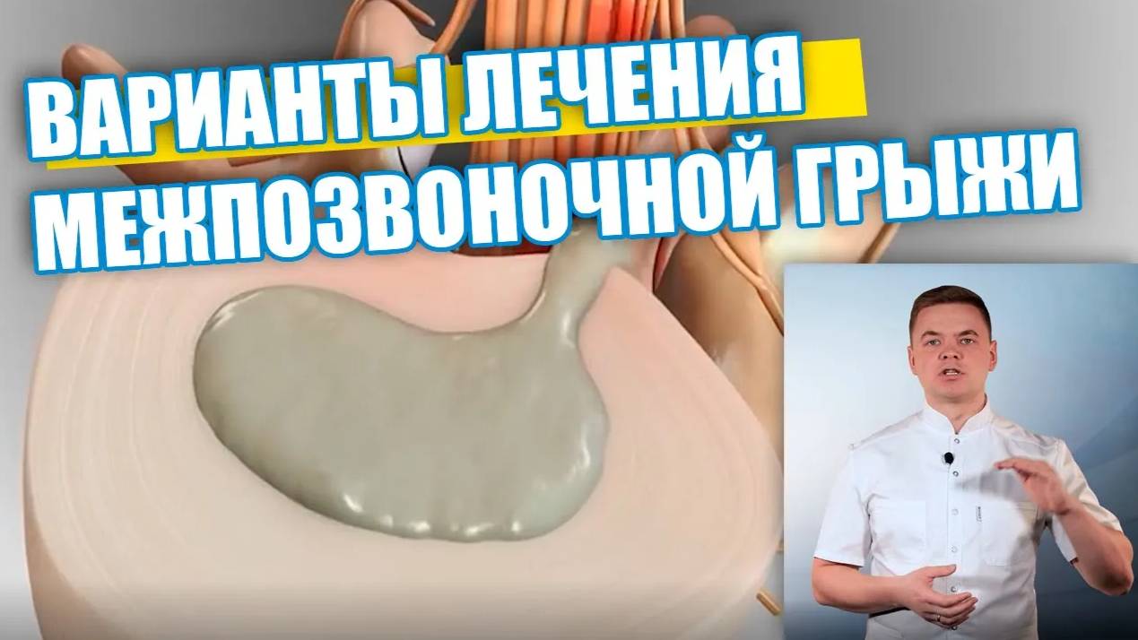 Тема: межпозвонковые грыжи и варианты их лечения