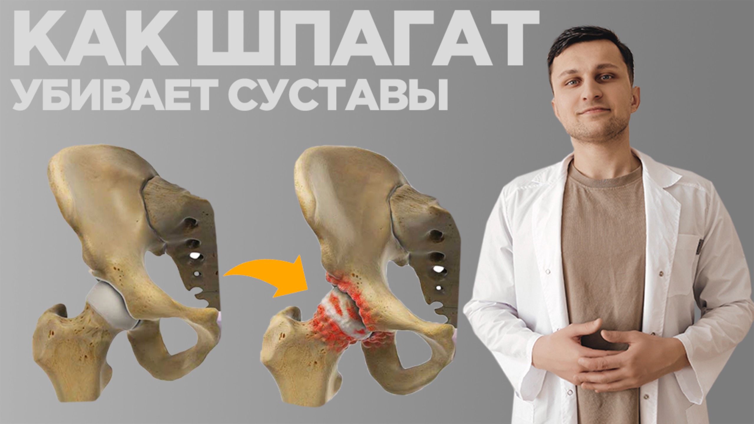 Печальные последствия ШПАГАТА. Почему Вам НЕ НУЖЕН шпагат.