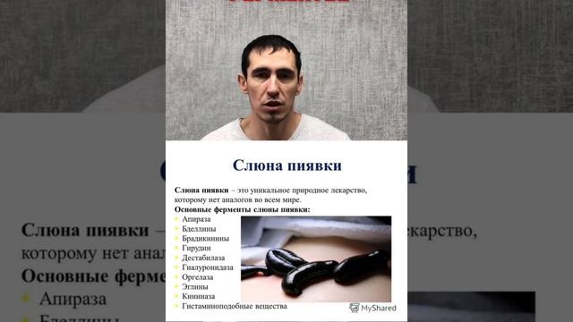 Гирудотерапия - лечение пиявками! #пиявки #гирудотерапия #висцеральнаятерапия #остеопатия