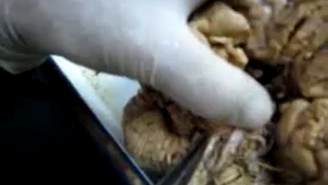 Brain Anatomy Using Real Human Brain.wmv смотреть онлайн