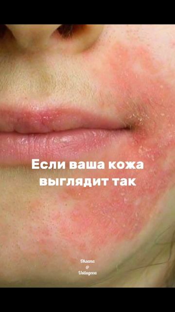 УХОД ЗА КОЖЕЙ