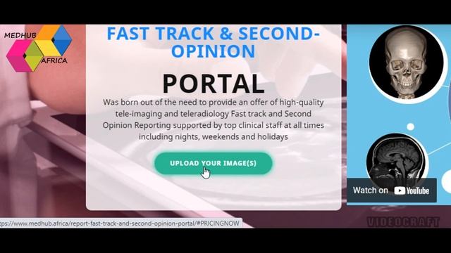 How to send a CT or MRI image on a CD Plate Online for reporting or second opinion.
