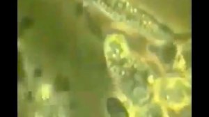 Лейкоциты разрывают раковую клетку